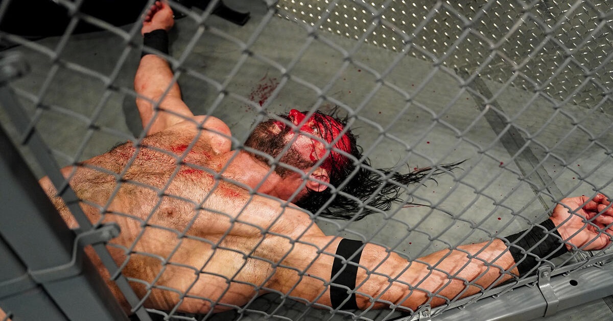 WWE: Video e foto della brutta ferita rimediata da Drew McIntyre a Bad Blood